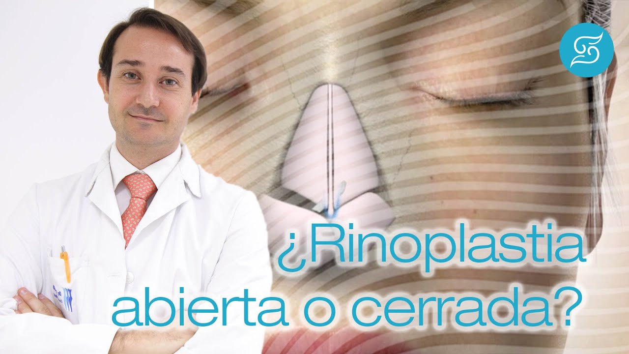 Francisco Solesio Pilarte-9