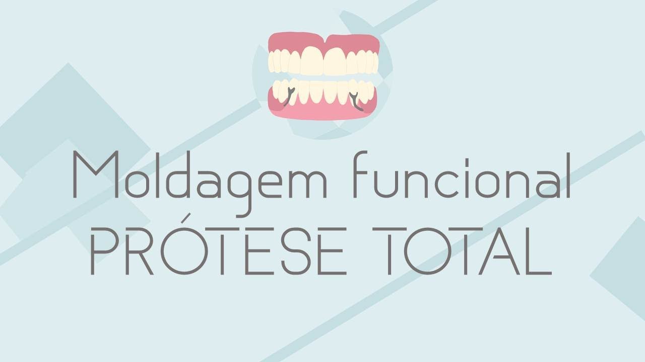 SEQUÊNCIA CLÍNICA Moldagem Funcional Propriamente Dita do Arco Inferior com Pasta ZOE (PT)