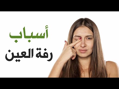 رفة العين .. الأسباب وطرق العلاج