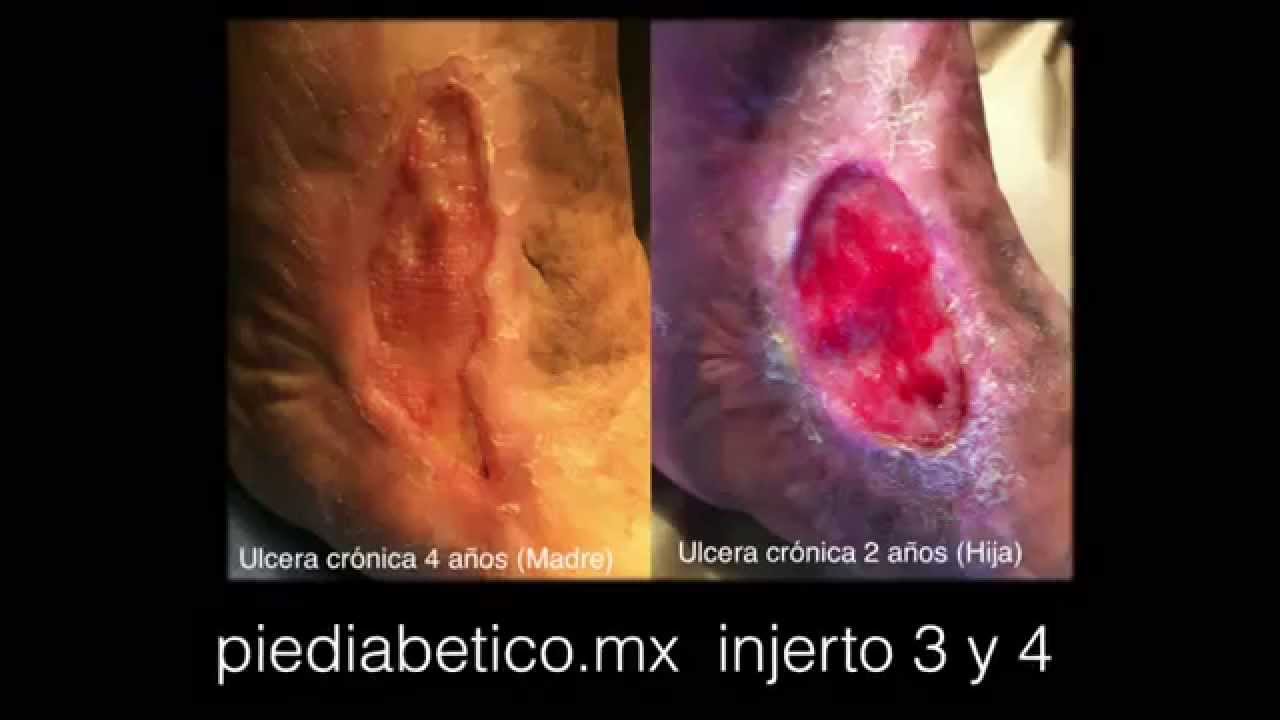 César Reyes Elizondo-12