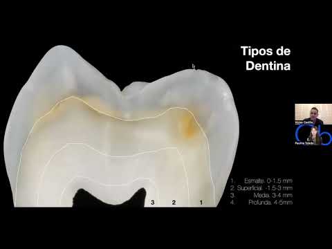 Tipos de Dentina, adhesión y bases