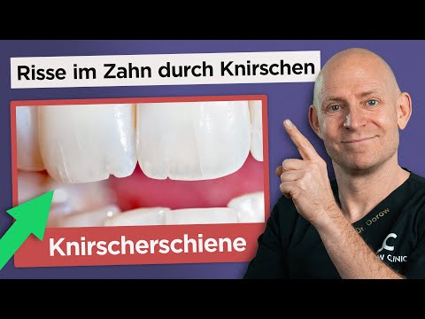Die richtige Knirscherschiene gegen Zähneknirschen (Bruxismus)