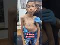 Scoliosistreatment Drrajneeshkant Rkm