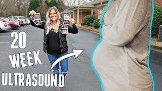 20 Week Ultrasound | Hearing Baby’s Heartbeat!