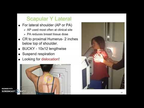 Humerus, Shoulder, Clavicle & Scapula x-ray protocol