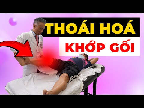 Đau Khớp Gối Khi Đi Cầu Thang? Đừng Để Thoái Hóa Khớp Cướp Đi Tuổi Trẻ