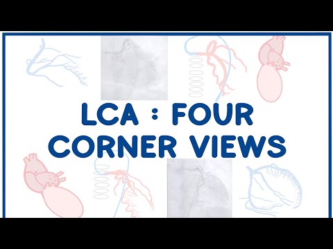Left Coronary Artery Angiogram: The Four Corners Overview