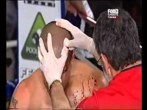 Shannon Taylor vs Sonni Michael Angelo