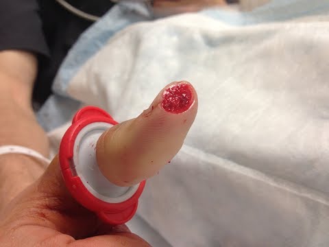 download lagu mp3 mp4 Mandolin Injury, download lagu Mandolin Injury gratis, unduh video klip Mandolin Injury