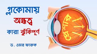 গ্লকোমায় কারা ঝুঁকিপূর্ণ | GLAUCOMA: WHO IS AT RISK | Dr. Omar Faruq | Glaucoma Specialist & Surgeon