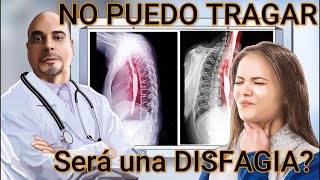 NO PUEDO TRAGAR BIEN..PARTE 2😣 Sera una DISFAGIA Cuales son las CAUSAS 😮