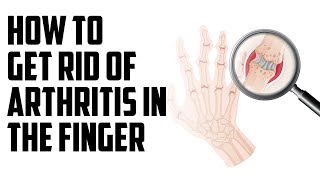 How to get rid of arthritis in the finger | B Episode 128