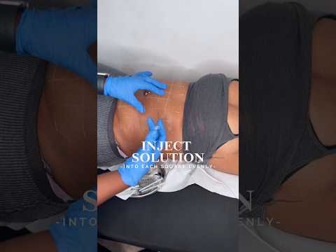 How To Do Fat Dissolving Injections | Reduce Stubborn Fat | Fat Melting Injections