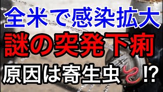 【謎の突発性下痢】尋常ではない激烈な水溶性の下痢症状が全米で急拡大!原因は“寄生虫“か⁉️ 生水・生野菜・果物に気をつけて下さい!