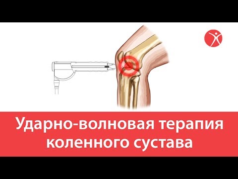 Может ли повышаться артериальное давление при шейном остеохондрозе Замена коленного сустава в корее цена
