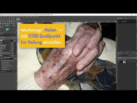 #12/32 Mit Heilen Schönheitsoperation durchführen