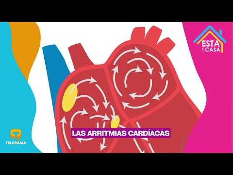 Las arritmias cardíacas 
