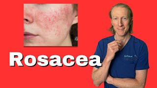 Your Guide to Rosacea: From Skin Redness to Emotional Wellness