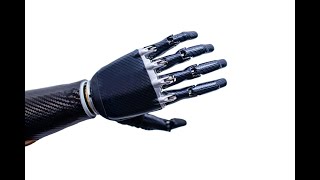 הנחת תפילין עם פרוטזה▪️הרב נחמנסון▪️(שטיינבאך שול כפר חב"ד) (הרב יהודה לייב נחמנסון) - התמונה מוצגת ישירות מתוך אתר האינטרנט יוטיוב. זכויות היוצרים בתמונה שייכות ליוצרה. קישור קרדיט למקור התוכן נמצא בתוך דף הסרטון