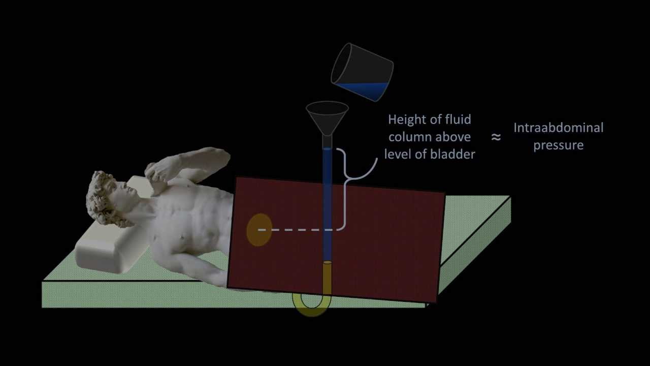 Hydrostatic Pressure - Medical Applications (Fluid Mechanics - Lesson 4)