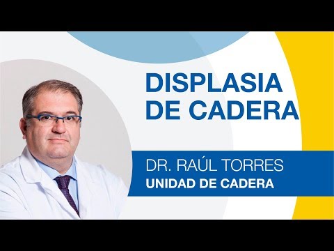 Displasia de Cadera