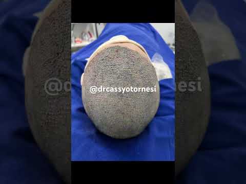 Cassyo Tornesi-19