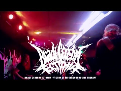 Bradi Cerebri Ectomia - Bradi Cerebri Ectomia - Victim Of Electroconvulsive Therapy (5.1