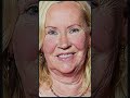 Elvis Costello’s SHOCKING Truth About Agnetha Faltskog