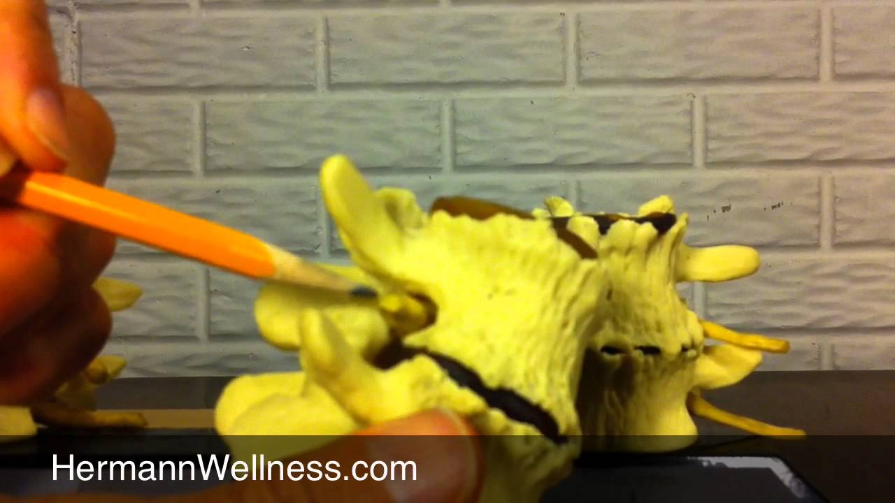 Spinal Degeneration Part 2