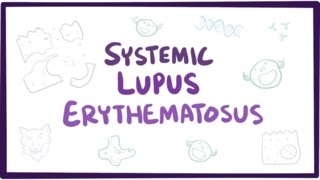 Systemic lupus erythematosus (SLE) - causes, symptoms, diagnosis & pathology