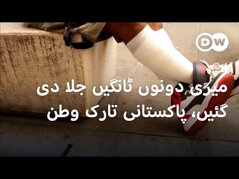 زخمی پاکستانی تارک وطن کا دکھ بانٹتے اطالوی شہری | DW Urdu | Burned but Unbroken: Arif's Story