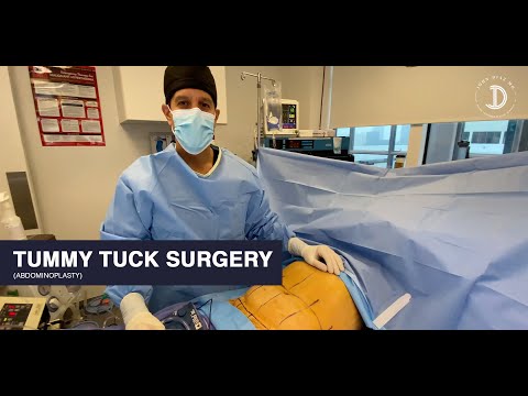 Best Surgery for Tummy Tuck in India