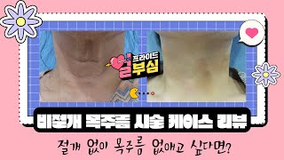 [목주름 시술리뷰] 절개 없이 목주름 없애고 싶다면!?