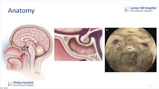 Neurosurgery Subspecialty: Pituitary Tumors with Dr. Silva