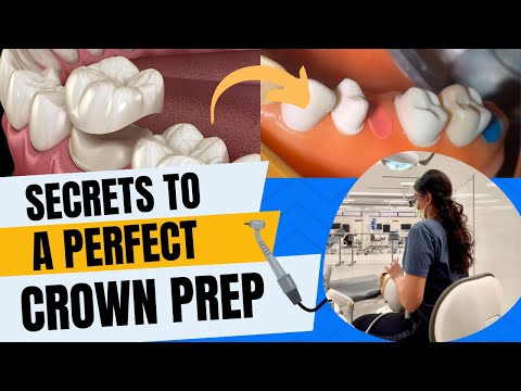Ace Your Bench Test on FIRST Try | Crown Prep Tricks + Free Resource