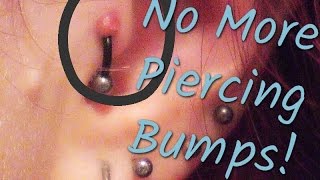 Secret to Getting Rid of Piercing Bumps OVERNIGHT! | DIY🖤