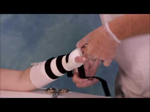 Afneembare Pols- en Duimspalk met Delta-Cast Soft