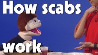 How Scabs Work | Kids Health | The Friday Zone | WTIU | PBS