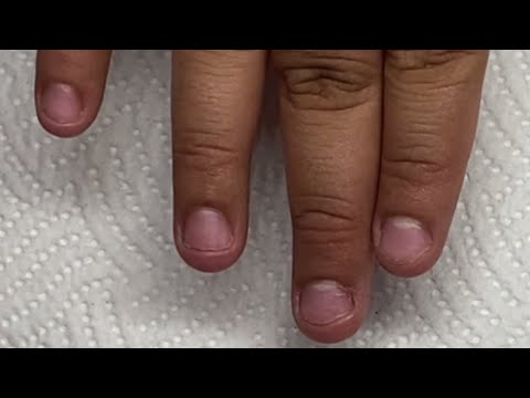 Cómo aplicar uñas en “UÑAS MORDIDAS” | ONICOFAGIA