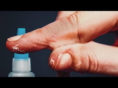 Video Thumbnail: Darum ist Sekundenkleber genial zum Wundkleben