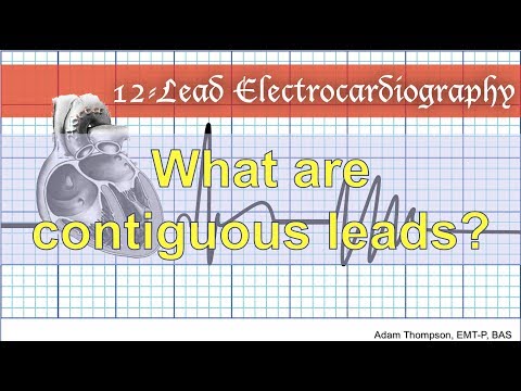 What are contiguous leads?