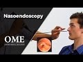 Nasoendoscopy (Nose Examination) - ENT