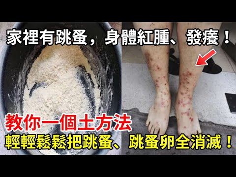 家裡有跳蚤，身體紅腫、發癢！用這個土方法，輕輕鬆鬆把跳蚤殺光光！跳蚤再也不敢進入你家！