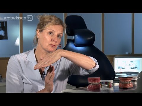 Lispeln - Warum beinflusst es Zahn-und Kieferwachstum?