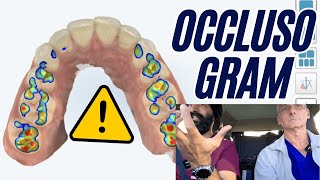 Occlusograms are Lying To Us! Don't Trust the Occlusion 'Heat Map' - PDP247