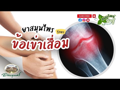 ข้อเข่าเสื่อม การรักษาด้วยยาสมุนไพร l สมุนไพรน่ารู้ (2024)