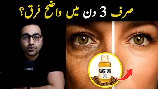 Download lagu Chaar hazaar saal purana raaz! | CASTOR OIL for Your Face - Dr. Zee mp3