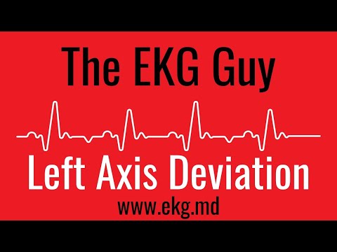 Left Axis Deviation on EKG / ECG l The EKG Guy - www.ekg.md