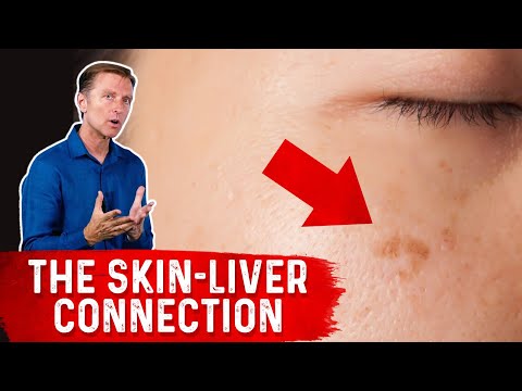 How Your Feet Are Warning You About Your Liver Problems Dr Berg Explains