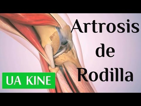gél az ízületek és a gerinc számára éles fájdalom a könyök ízületeiben